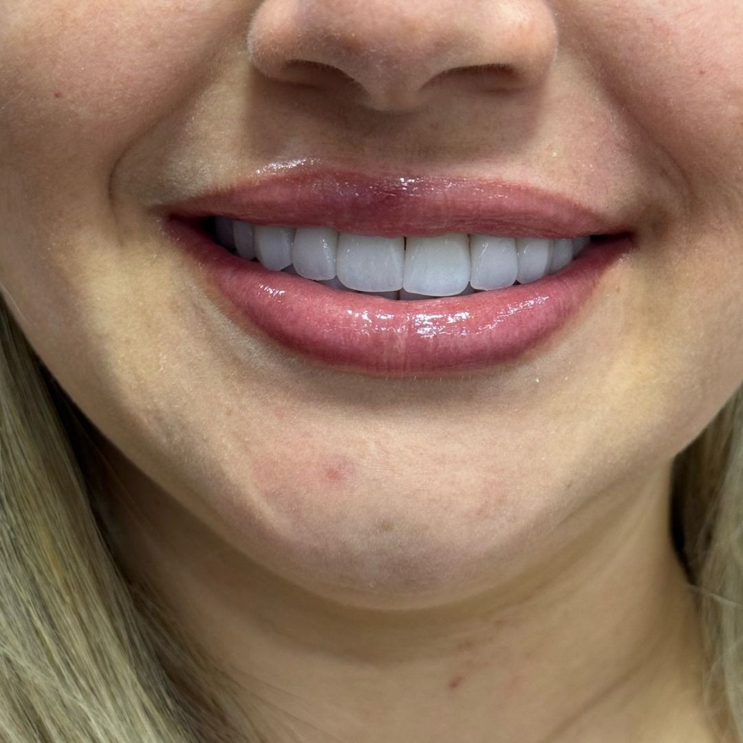 313578f7-5809-4103-b253-fc9f8c6219ee