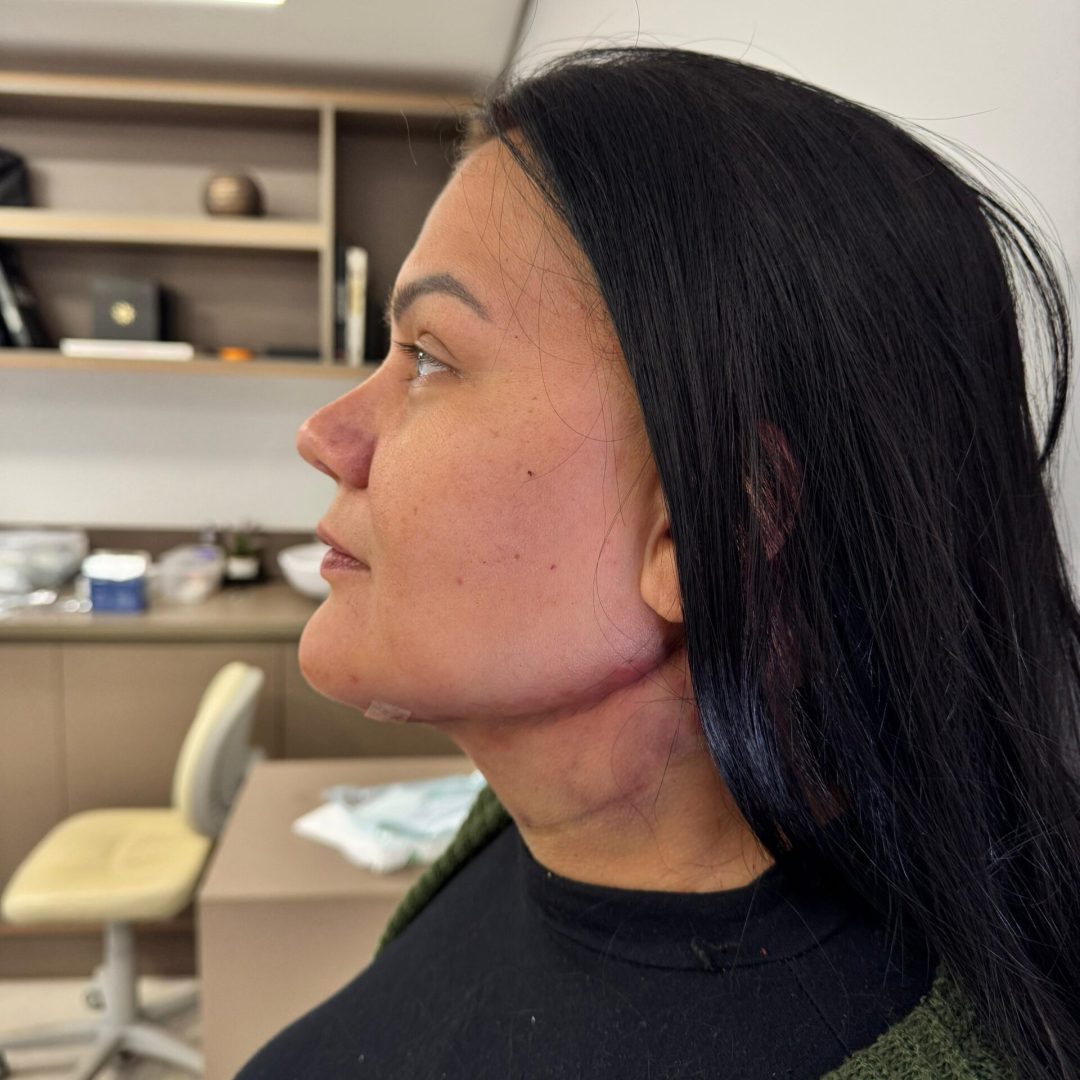 WhatsApp Image 2025-06-05 at 11.45.22